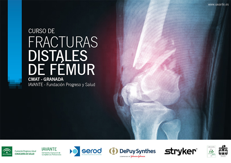 Curso de Fracturas Distales de Fémur